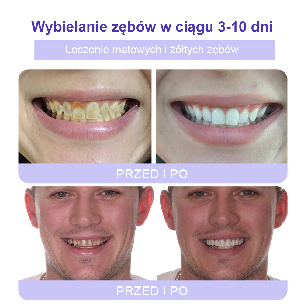 Cvreoz® Proszek Mineralny do Przywracania Zębów (zalecane przez ADA) (👩⚕️ Ostatnia szansa na zniżkę - tylko przez 30 minut 🦷)