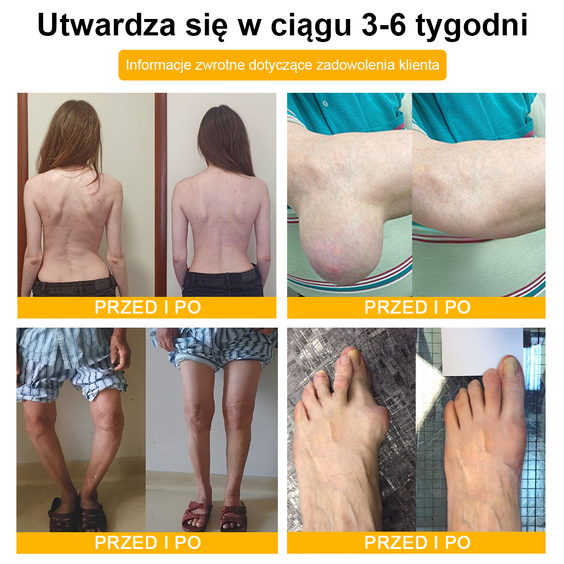 TLOPA® Toksyna botulinowa i jad pszczeli Krem przeciwbólowy do gojenia kości🦴