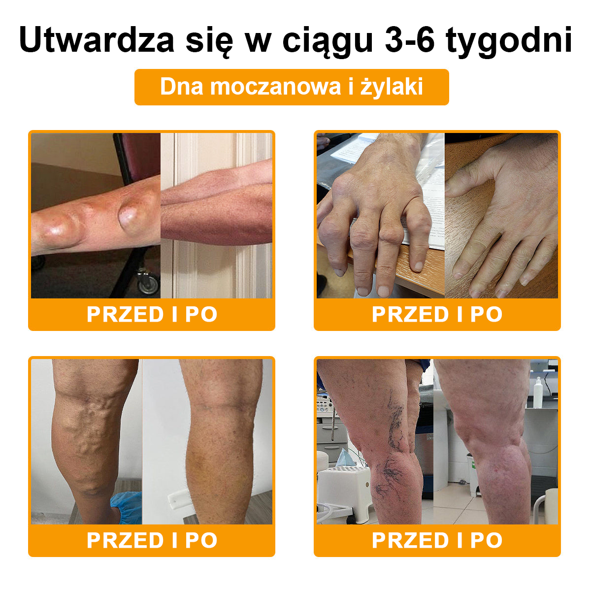 TLOPA® Toksyna botulinowa i jad pszczeli Krem przeciwbólowy do gojenia kości🦴