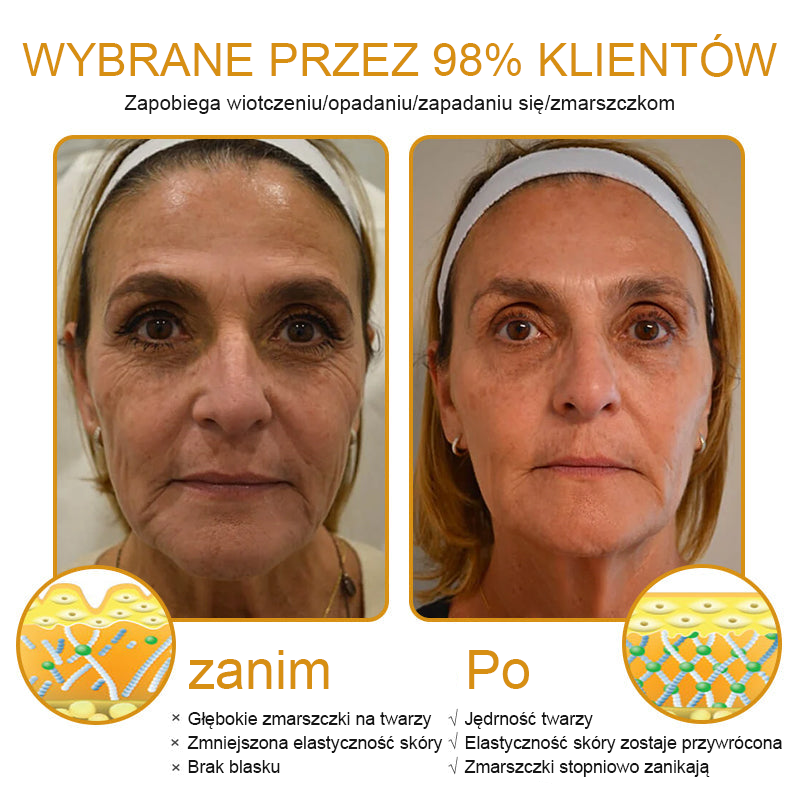 FrissArc™ Botox Jadem Pszczelim przeciwzmarszczkowy Krem – Redukuje zmarszczki, ujędrnia i rozjaśnia skórę – Krem przeciwstarzeniowy o podwójnym działaniu✨