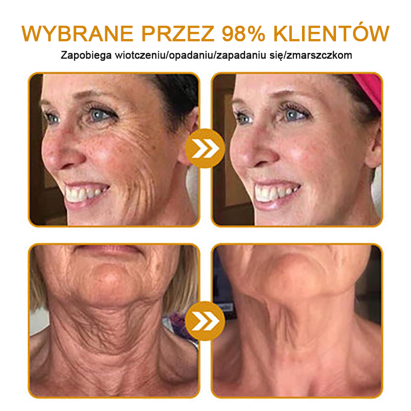FrissArc™ Botox Jadem Pszczelim przeciwzmarszczkowy Krem – Redukuje zmarszczki, ujędrnia i rozjaśnia skórę – Krem przeciwstarzeniowy o podwójnym działaniu✨