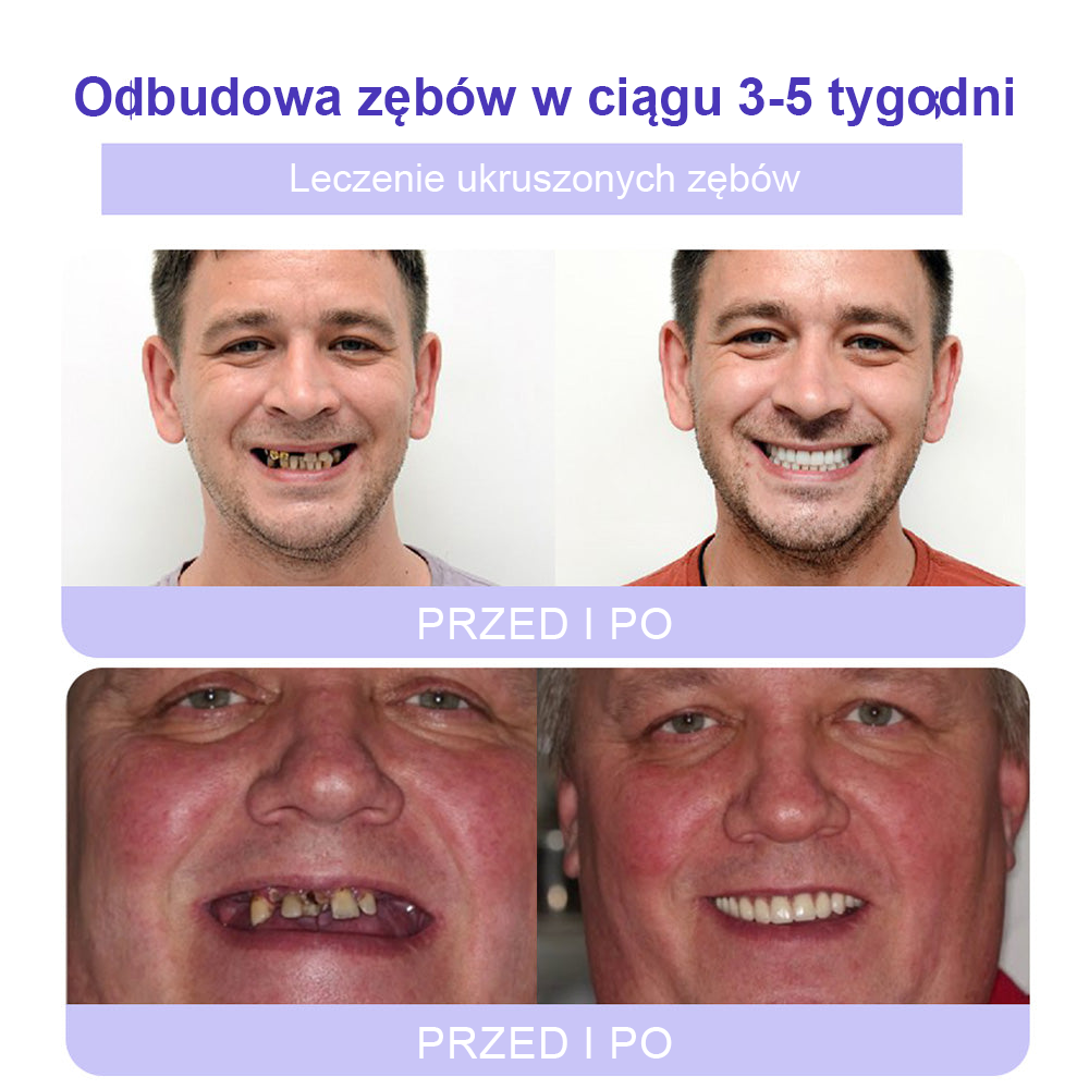 Cvreoz® Proszek Mineralny do Przywracania Zębów (zalecane przez ADA) (👩⚕️ Ostatnia szansa na zniżkę - tylko przez 30 minut 🦷)
