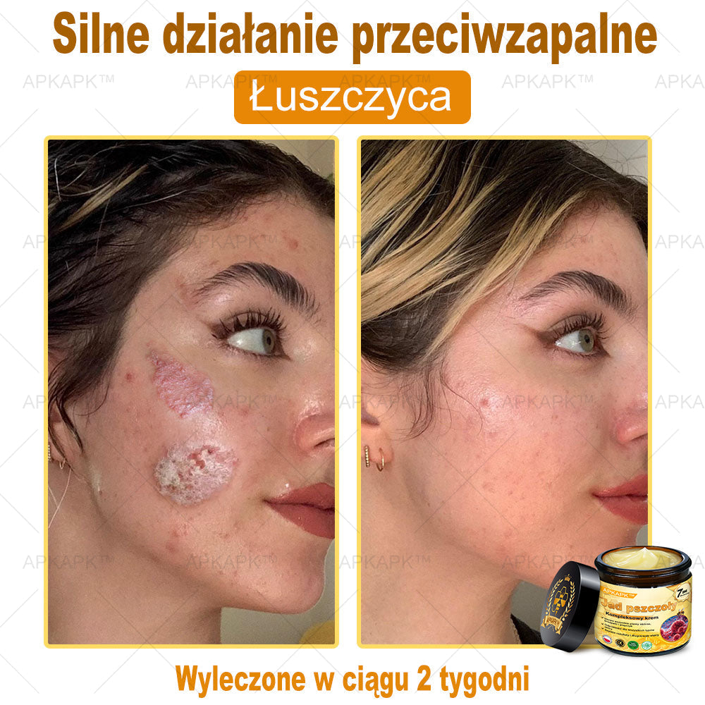 🔥🔥 Zostało tylko 5 pudełek! Dajemy dodatkową zniżkę 50%! Spraw, aby Twoje ciało było zdrowsze! Jeśli teraz to przegapisz, dostaniesz to dopiero w przyszłym roku - APKAPK