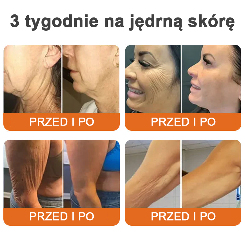 Gotówka przy odbiorze ✨ Turonu™ Botox Bee Venom Firming Serum Stick (🔥Ostatni dzień 70% zniżki) 💄