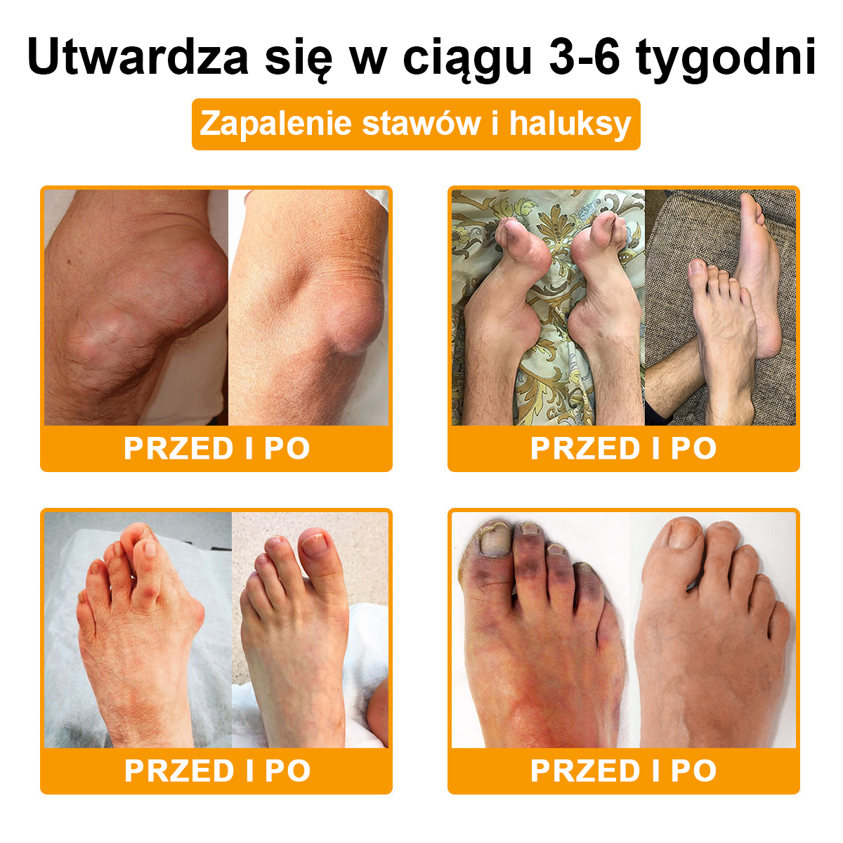 TLOPA® Toksyna botulinowa i jad pszczeli Krem przeciwbólowy do gojenia kości🦴