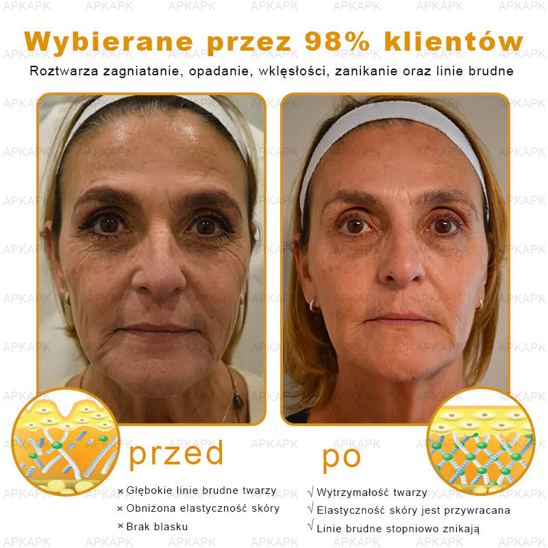 🔥🔥 Zostało tylko 5 pudełek! Dajemy dodatkową zniżkę 50%! Spraw, aby Twoje ciało było zdrowsze! Jeśli teraz to przegapisz, dostaniesz to dopiero w przyszłym roku - APKAPK