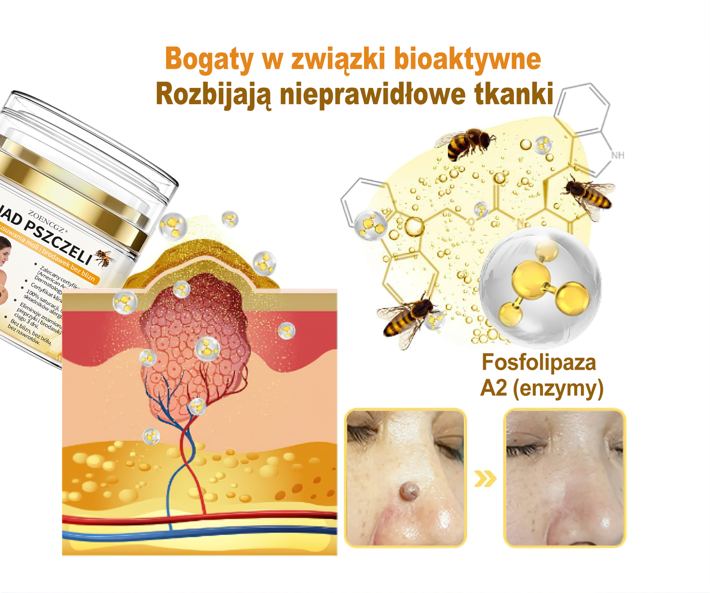 🏆 Zoencgz™ krem z jadem pszczelim na znamiona i brodawki(Certyfikacja PZH)