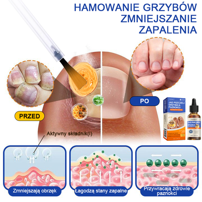 🐝Furzero™ Bienengift Nagelpilz Leczenie: Całkowite rozwiązanie problemu grzybicy paznokci🌟