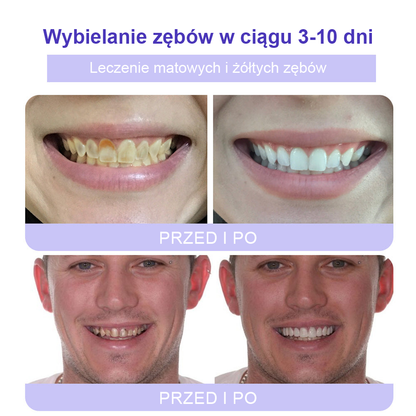 Cvreoz® Proszek Mineralny do Przywracania Zębów (zalecane przez ADA) (👩‍⚕️ Ostatnia szansa na zniżkę - tylko przez 30 minut 🦷)