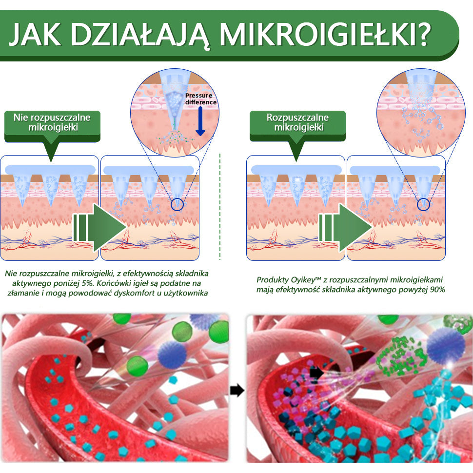 [Zobacz wyniki w ciągu 7 dni]🌻𝗧𝗟𝗢𝗣𝗔® 𝗚𝗟𝗣-𝟭 Nano Microneedle Patch🎀🎀（Bezbolesny, długotrwały, zwalczający cukrzycę, otyłość i choroby układu krążenia）