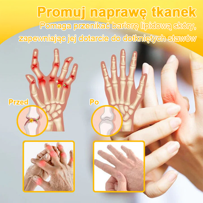 TLOPA® Toksyna botulinowa i jad pszczeli Krem przeciwbólowy do gojenia kości🦴
