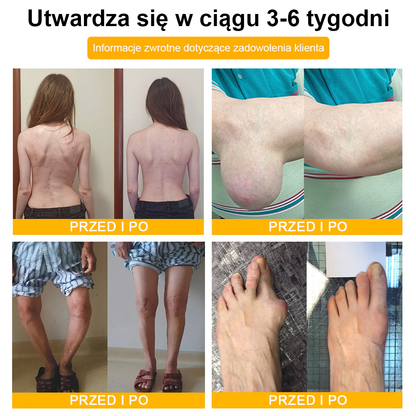 TLOPA® Toksyna botulinowa i jad pszczeli Krem przeciwbólowy do gojenia kości🦴