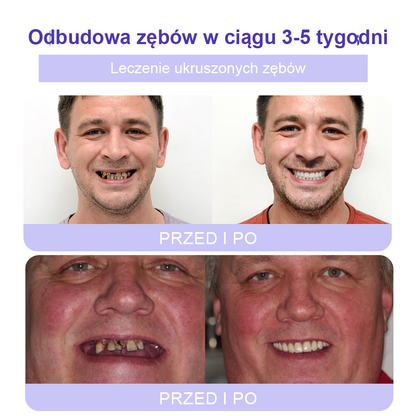 Cvreoz® Proszek Mineralny do Przywracania Zębów (zalecane przez ADA) (👩‍⚕️ Ostatnia szansa na zniżkę - tylko przez 30 minut 🦷)