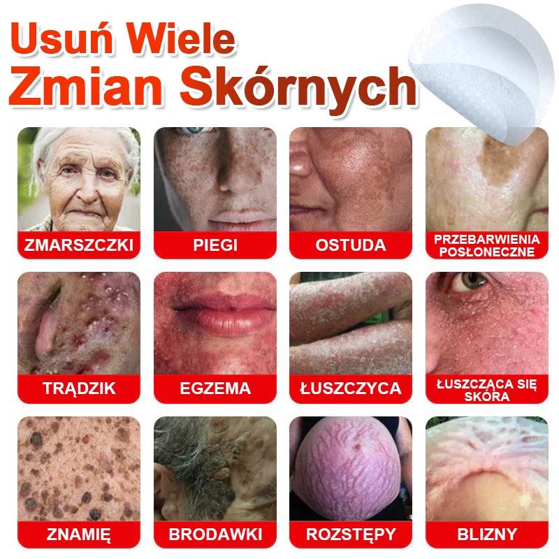 TLOPA® Mikroigłowy Botaniczny Plaster do Usuwania Narośli Skórnych 🇵🇱 Wyprodukowano w Polsce