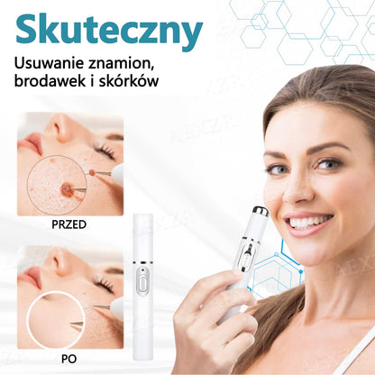 Cvreoz® nowy nieinwazyjny laser do usuwania pieprzyków i brodawek 🎉🎉