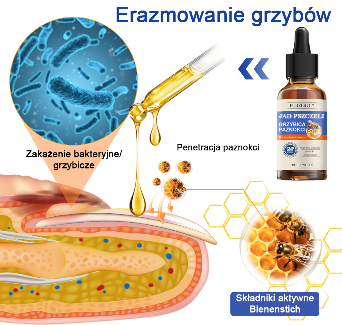 🐝Furzero™ Bienengift Nagelpilz Leczenie: Całkowite rozwiązanie problemu grzybicy paznokci🌟