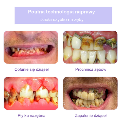 Cvreoz® Proszek Mineralny do Przywracania Zębów (zalecane przez ADA) (👩‍⚕️ Ostatnia szansa na zniżkę - tylko przez 30 minut 🦷)