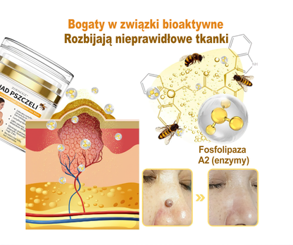 🏆 Zoencgz™ krem z jadem pszczelim na znamiona i brodawki(Certyfikacja PZH)